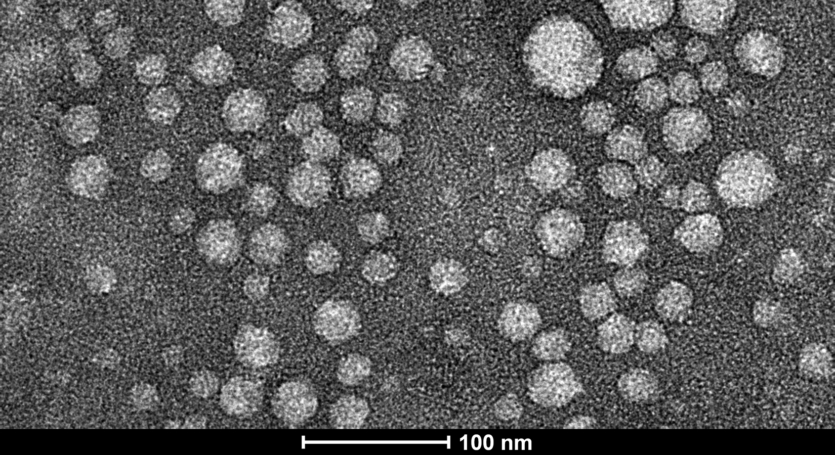 Nanoparticles Transmisson Electronic Microscopy micrograph (1)