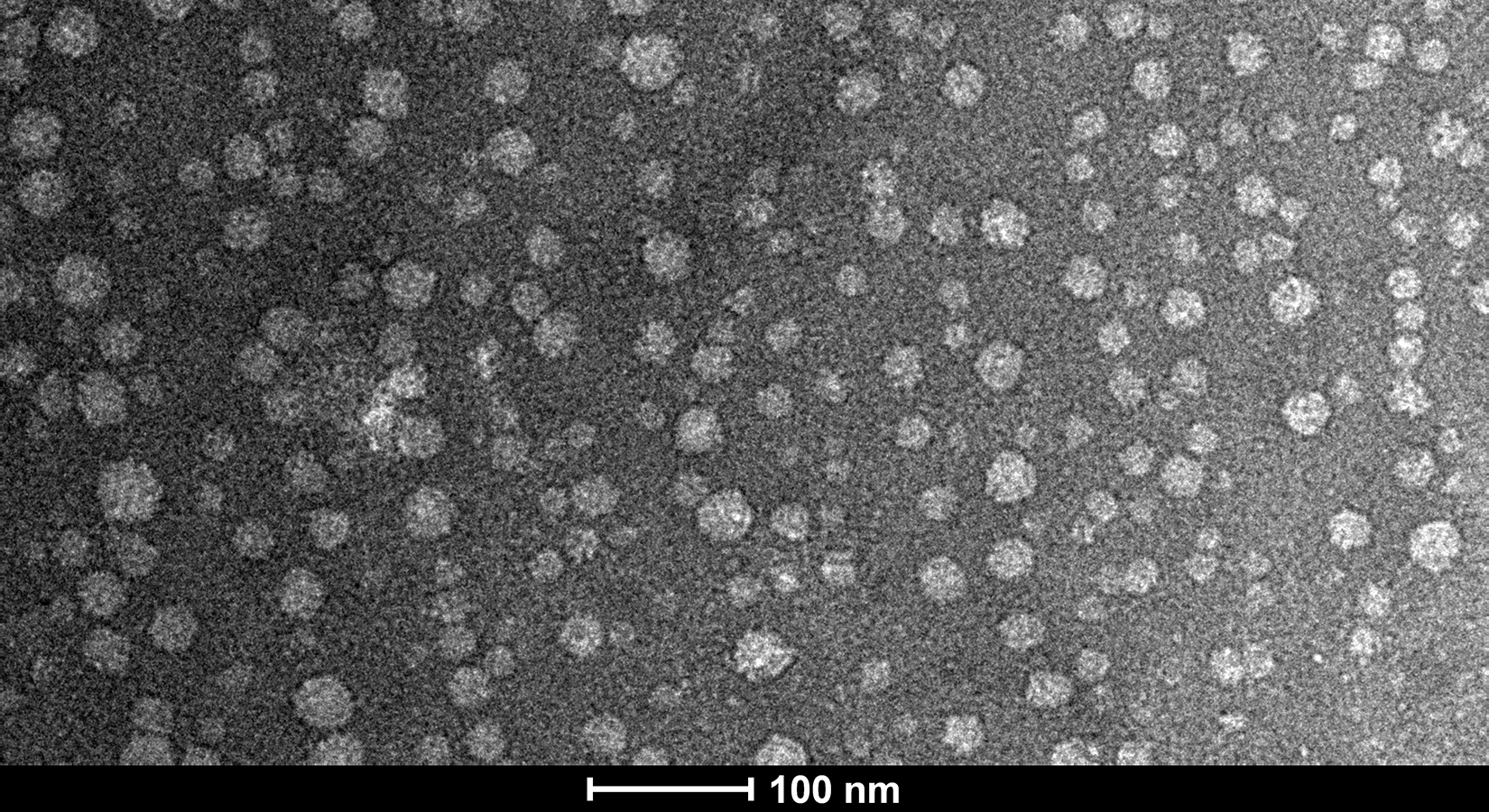 Nanoparticles Transmisson Electronic Microscopy micrograph (2)