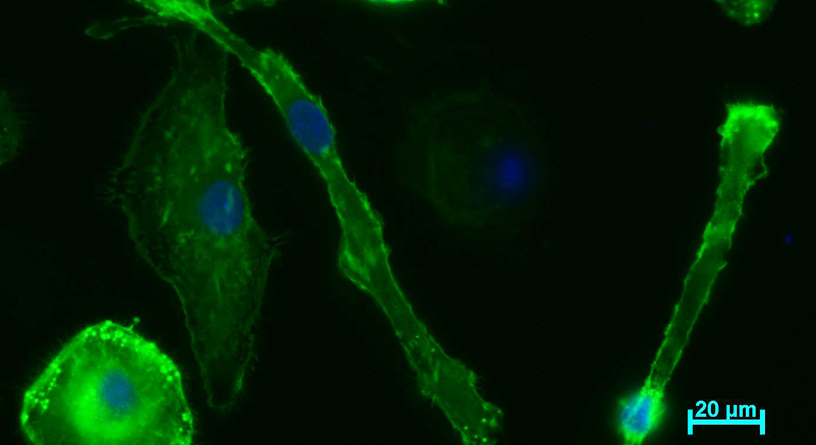 Nanoparticles internalised in macrophages