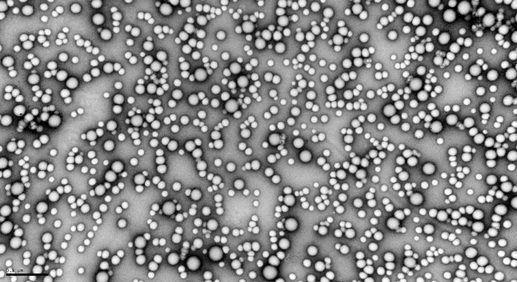 Nanoparticles Transmisson Electronic Microscopy micrograph (3)