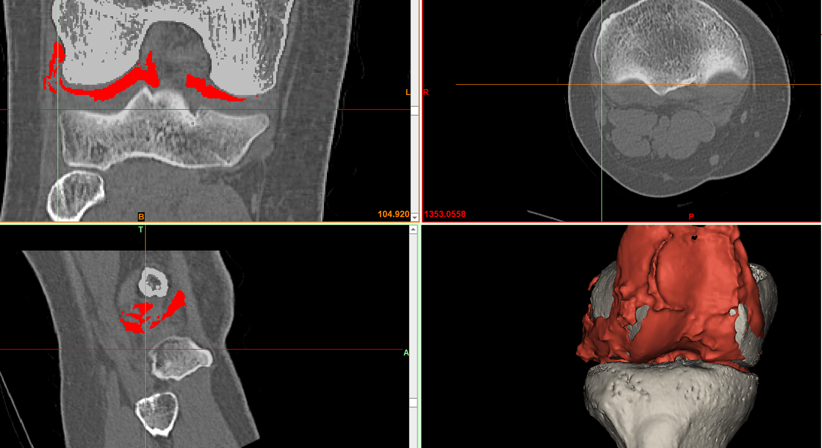 Cartilage Bone 3D model - overview