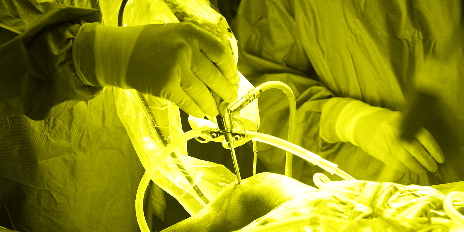 severe_lesion_chondyle_knee