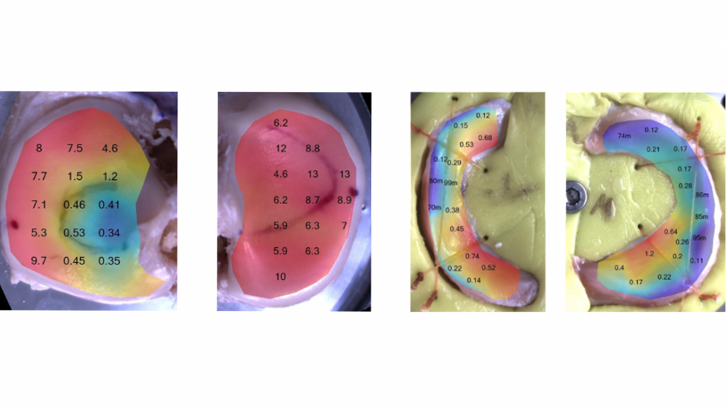 Automated Indentation Mapping – appropriate tool to investigate whole joint surfaces