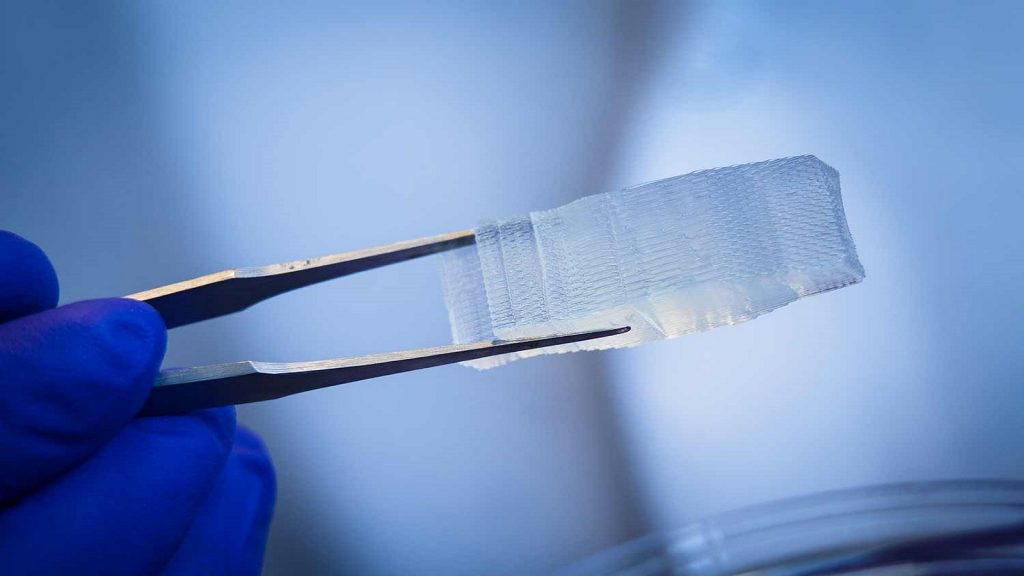 Local patterning of biophysical and biochemical properties – a smart tool for the design of biomaterials in regenerative medicine