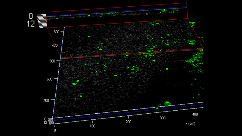 RESTORE Colloids Surfaces Biointerfaces