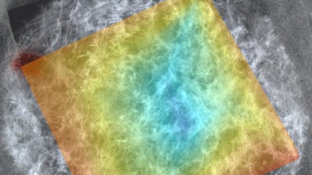About Scaffolds for Cartilage Regeneration