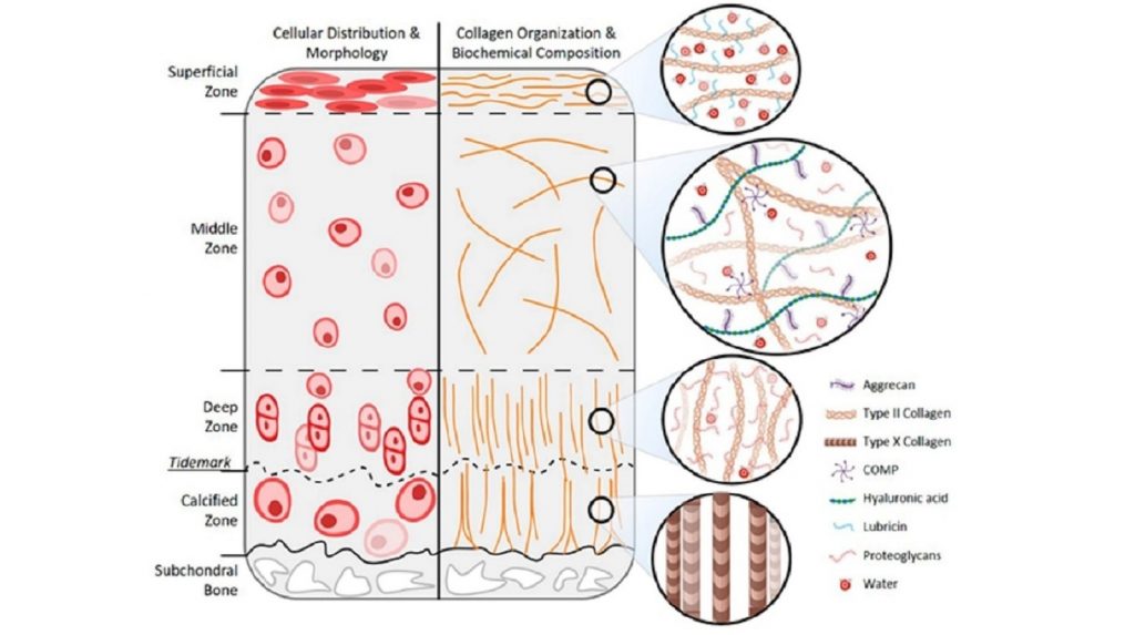 New Review: The Crossroad Between Degenerated Articular Cartilage and Tissue Engineering